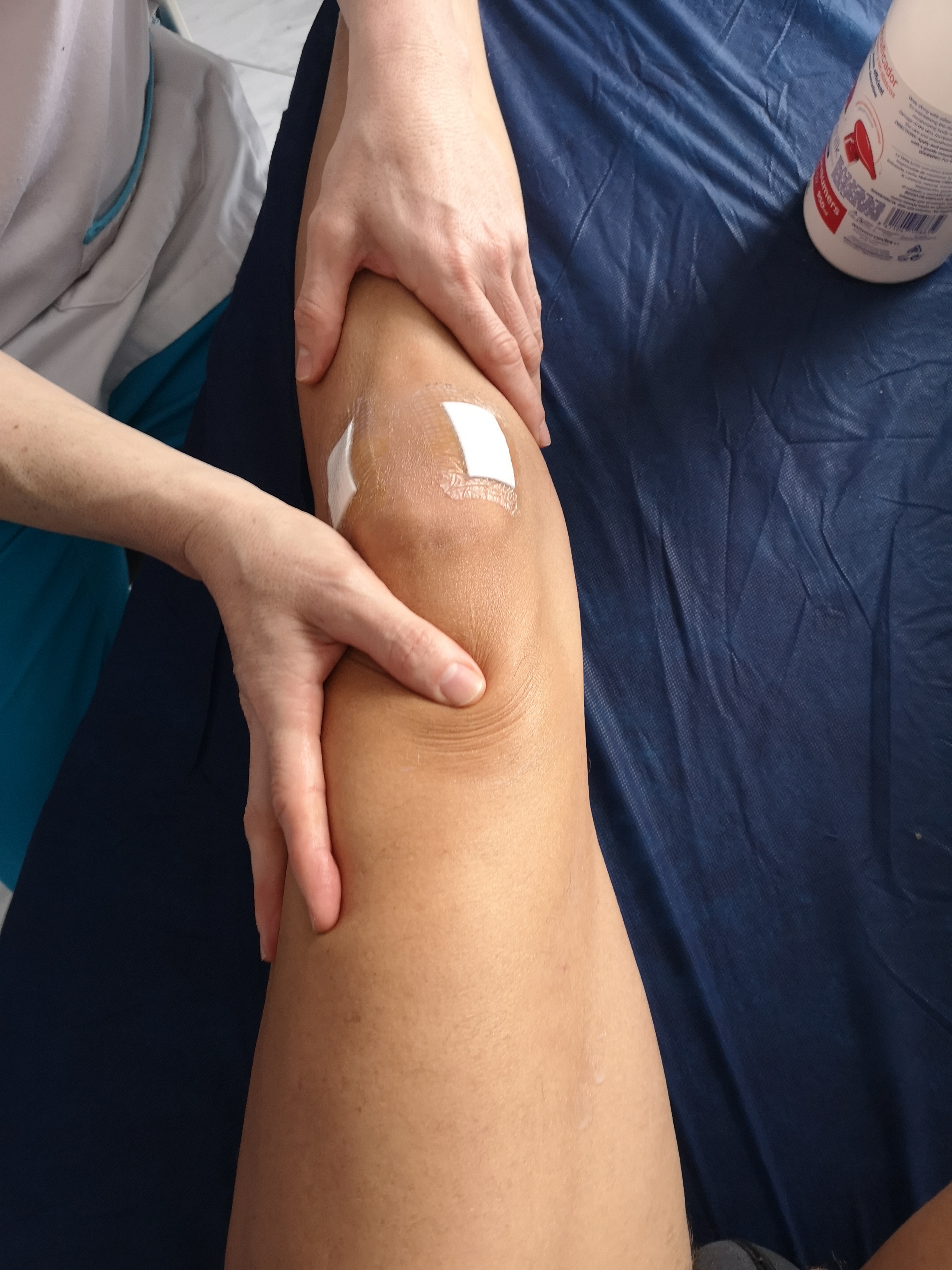 Recuperación Funcional